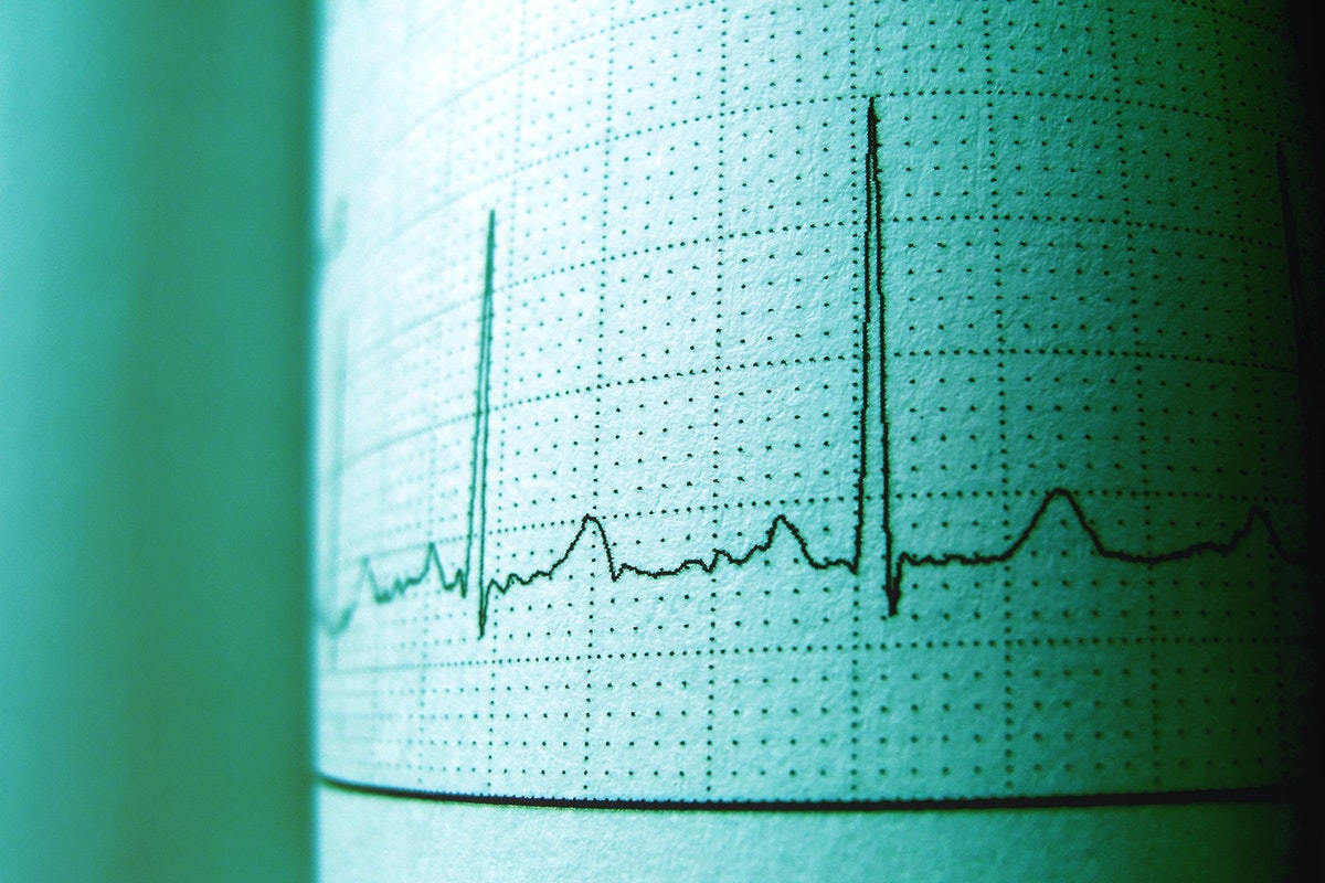 Frecuencia Cardiaca En Reposo ¿por Qué Es Importante Medirla 1062